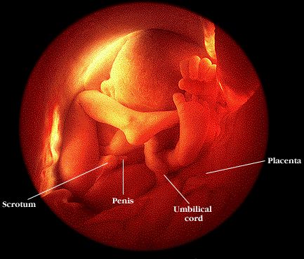 abortion at 8 weeks. 8 weeks now.